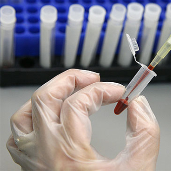 Why blood testing